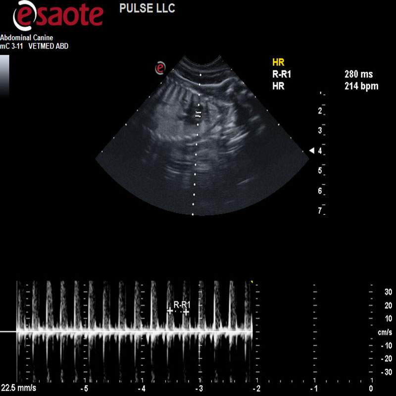 PREGNANCY ULTRASOUND