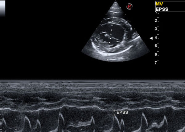 ECHOCARDIOGRAM