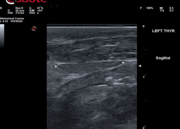 NECK ULTRASOUND