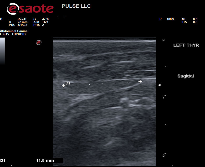 NECK ULTRASOUND