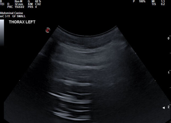 THORACIC ULTRASOUND