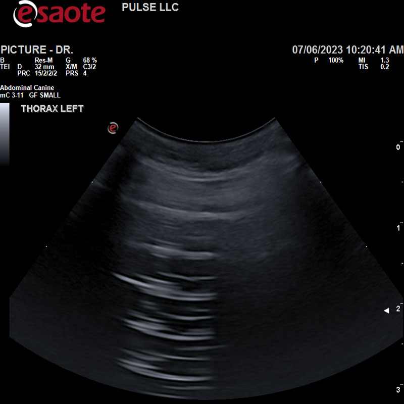 THORACIC ULTRASOUND